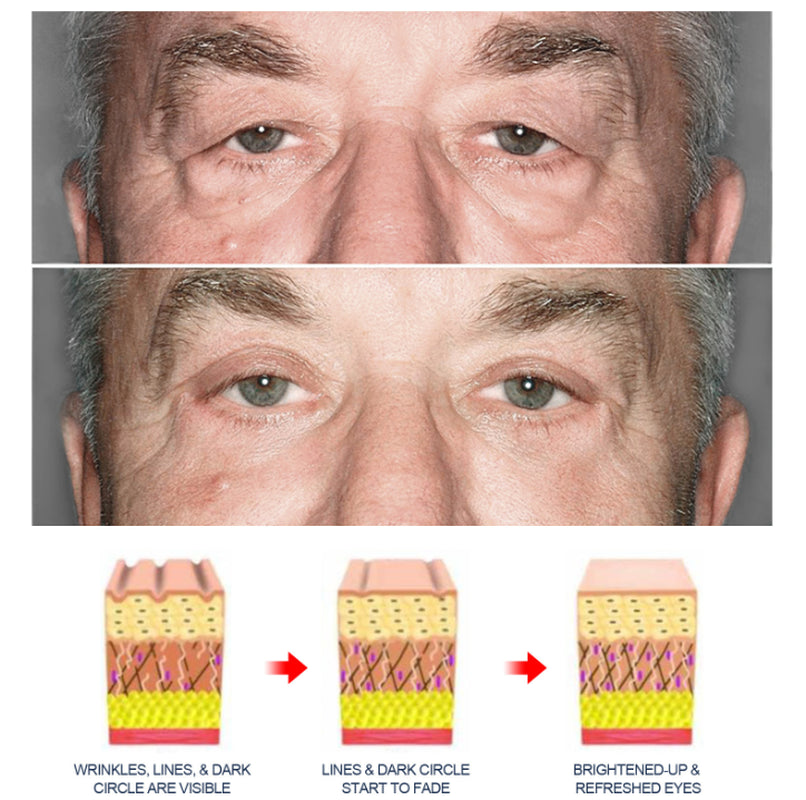 OPENEYES Awaken Lifting Eye Gel （1+1 Buy One Get One Free）