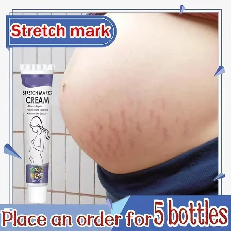 Stretch Marks Treatment Repair Essential Oil Skin Care Cream for Maternity Remover Anti-Wrinkle Slackline for Pregnant Body Oils