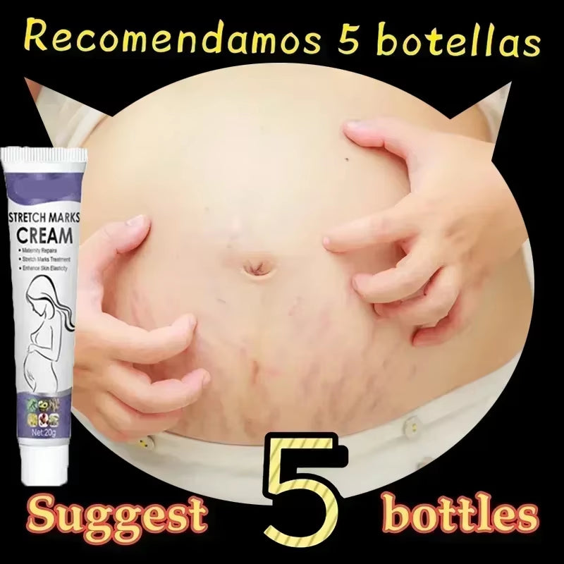 Stretch Marks Treatment Repair Essential Oil Skin Care Cream for Maternity Remover Anti-Wrinkle Slackline for Pregnant Body Oils