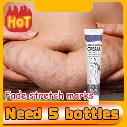 Stretch Marks Treatment Repair Essential Oil Skin Care Cream for Maternity Remover Anti-Wrinkle Slackline for Pregnant Body Oils