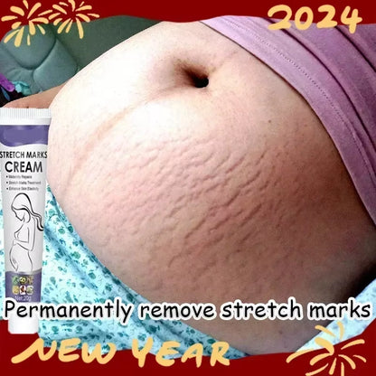 Stretch Marks Treatment Repair Essential Oil Skin Care Cream for Maternity Remover Anti-Wrinkle Slackline for Pregnant Body Oils
